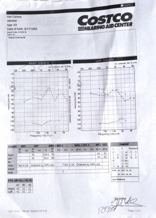 Alys's hearing test